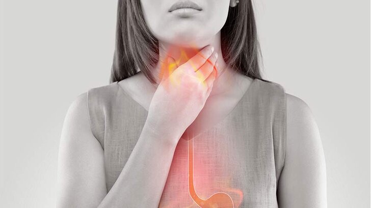 heartburn-1