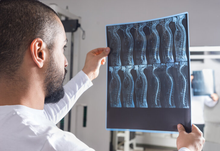 spinal-cord-injury-3